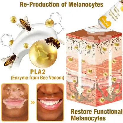 🐝 Bee Venom Repair Cream – Natural Skin Nourishment | Buy 1 Get 1 Free
