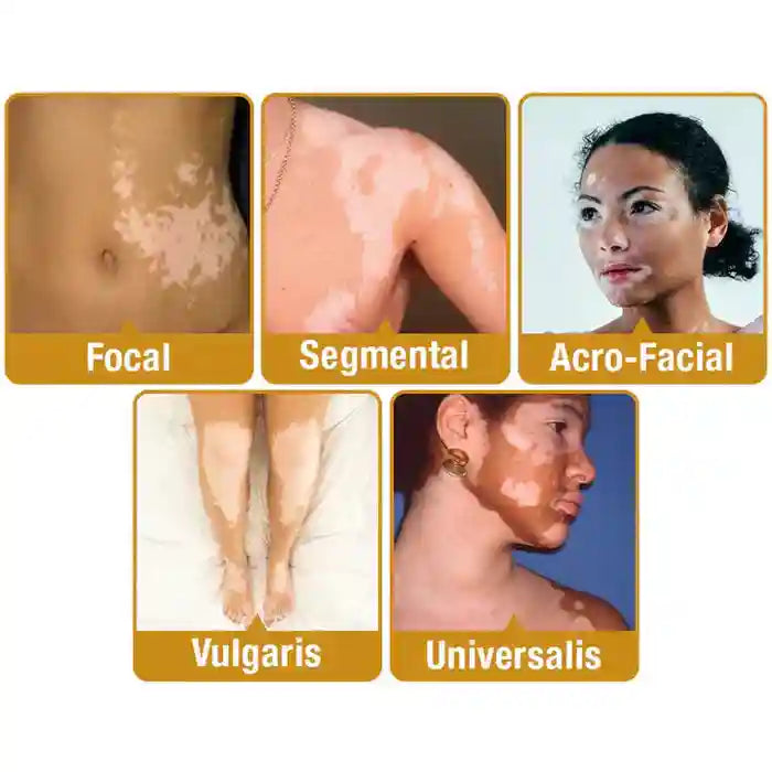 🐝 Bee Venom Repair Cream – Natural Skin Nourishment | Buy 1 Get 1 Free