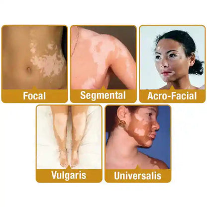 🐝 Bee Venom Repair Cream – Natural Skin Nourishment | Buy 1 Get 1 Free